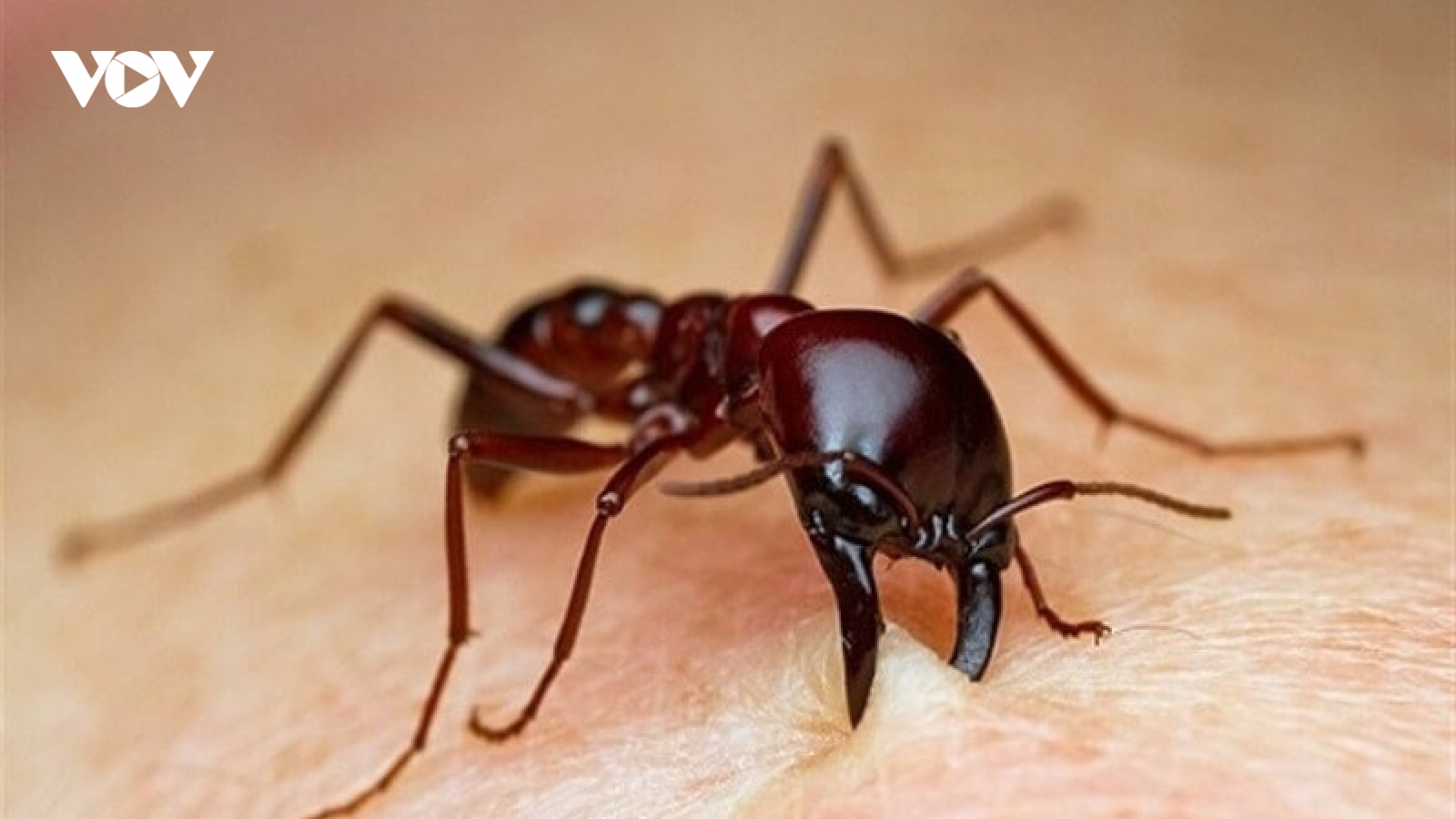 Mẹo điều trị khi bị kiến cắn