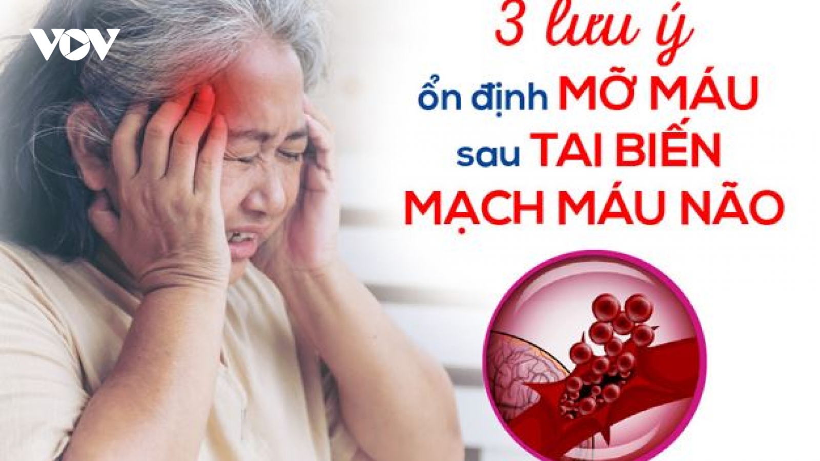 3 lưu ý để ổn định mỡ máu sau tai biến mạch máu não
