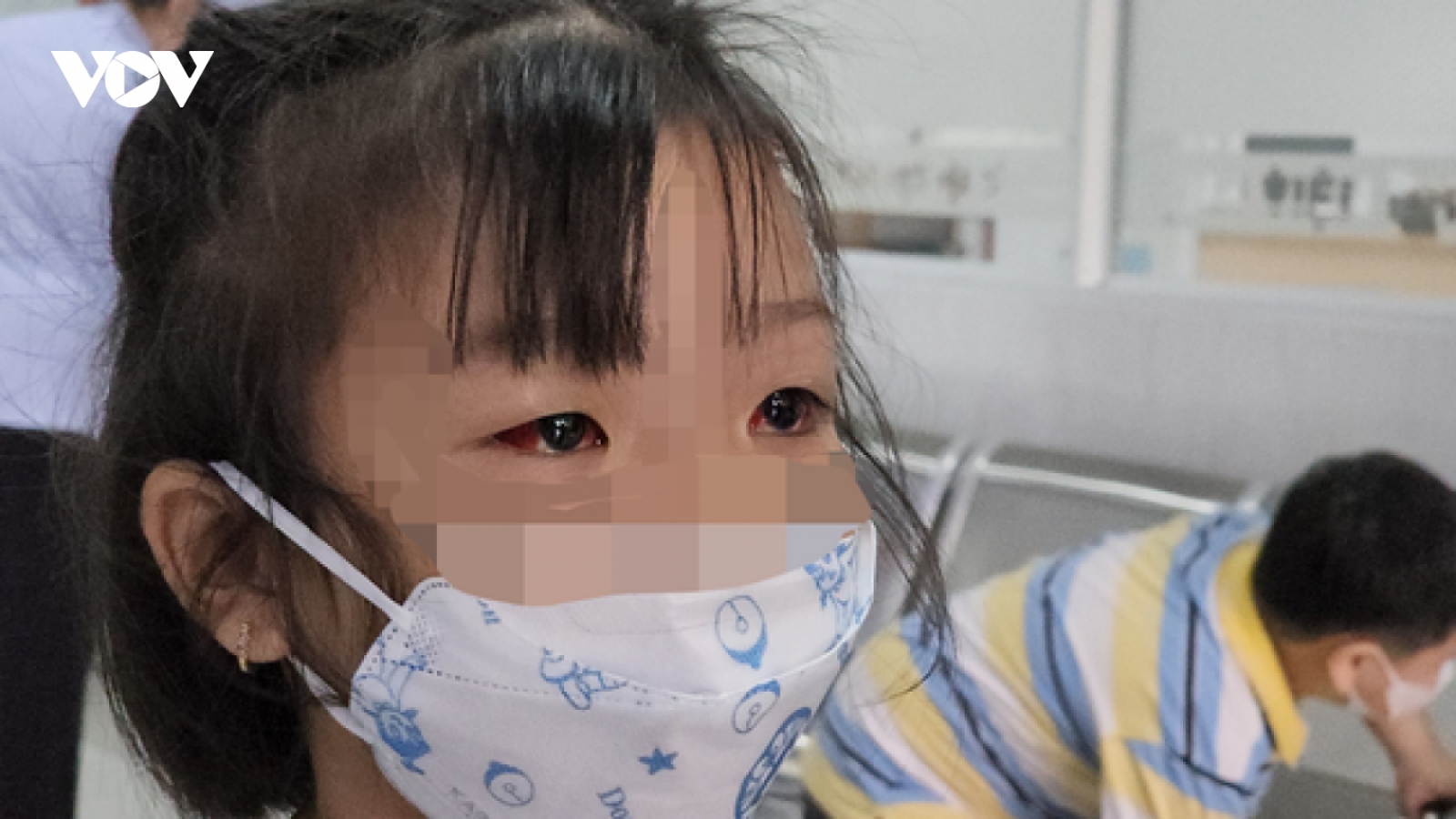 Đau mắt đỏ ở trẻ gia tăng, cảnh báo tình trạng dùng kháng sinh bừa bãi