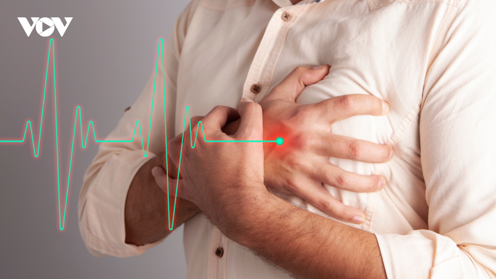Điều trị rung nhĩ như thế nào để ngăn biến chứng đột quỵ?
