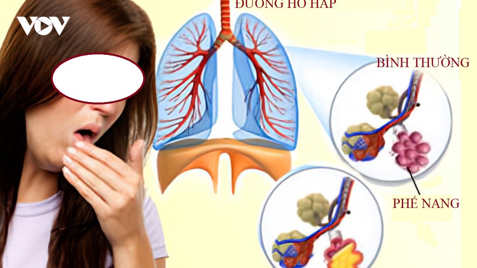 Thông tin hữu ích cho người có biểu hiện ho ra máu