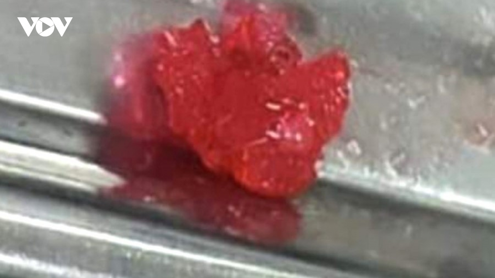 Hóc kẹo dẻo, bé trai tử vong sau 2 giờ vào viện cấp cứu