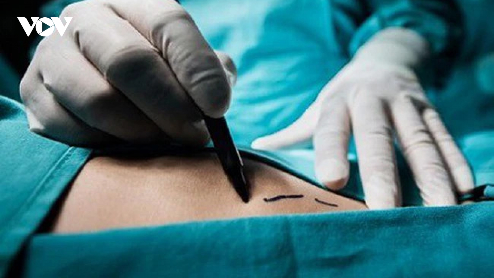 Bóc gỡ đường dây mua, bán thận liên tỉnh, bắt giữ 4 đối tượng