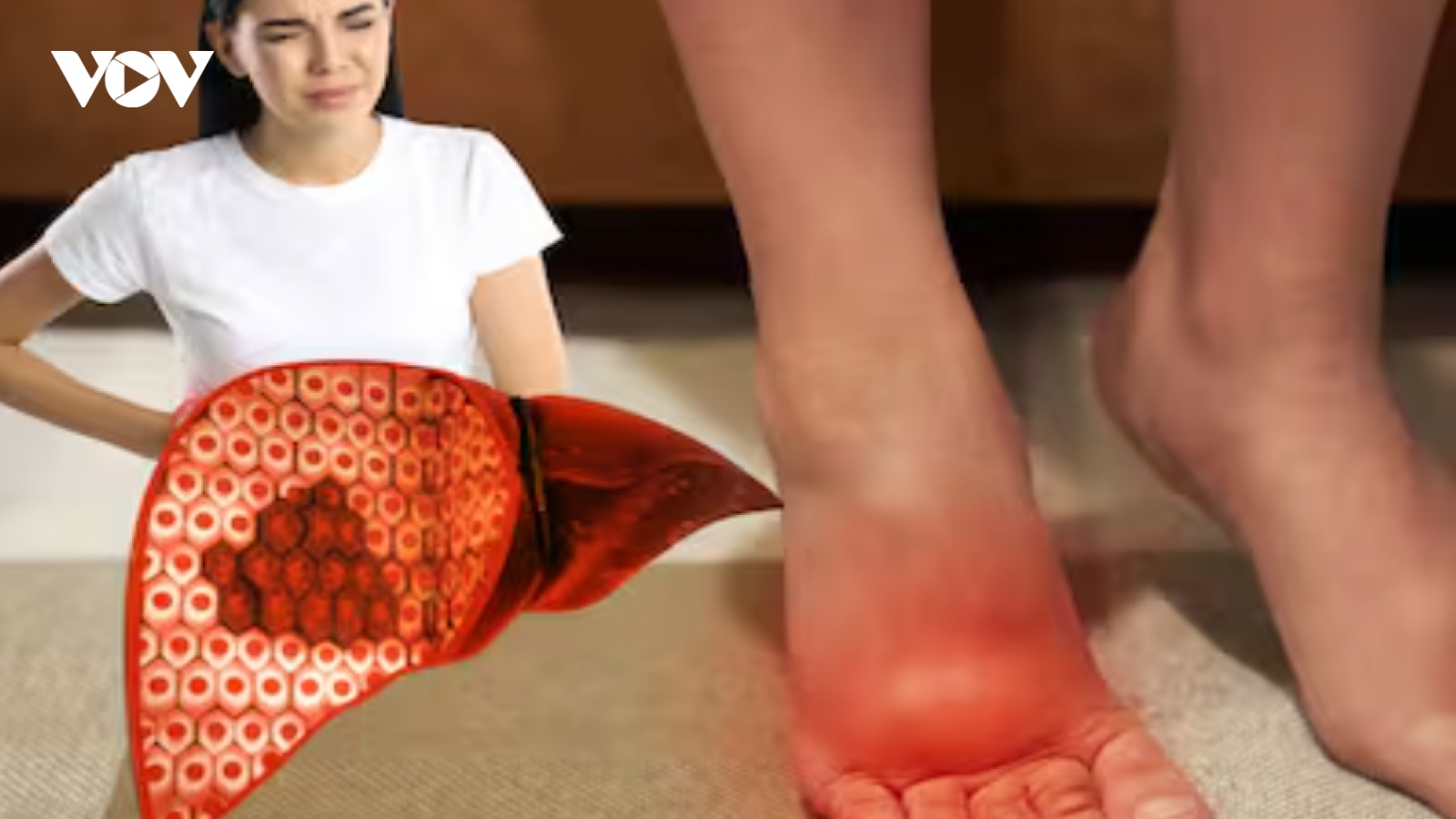 6 bộ phận trên cơ thể sưng tấy bất thường cảnh báo tổn thương gan nghiêm trọng