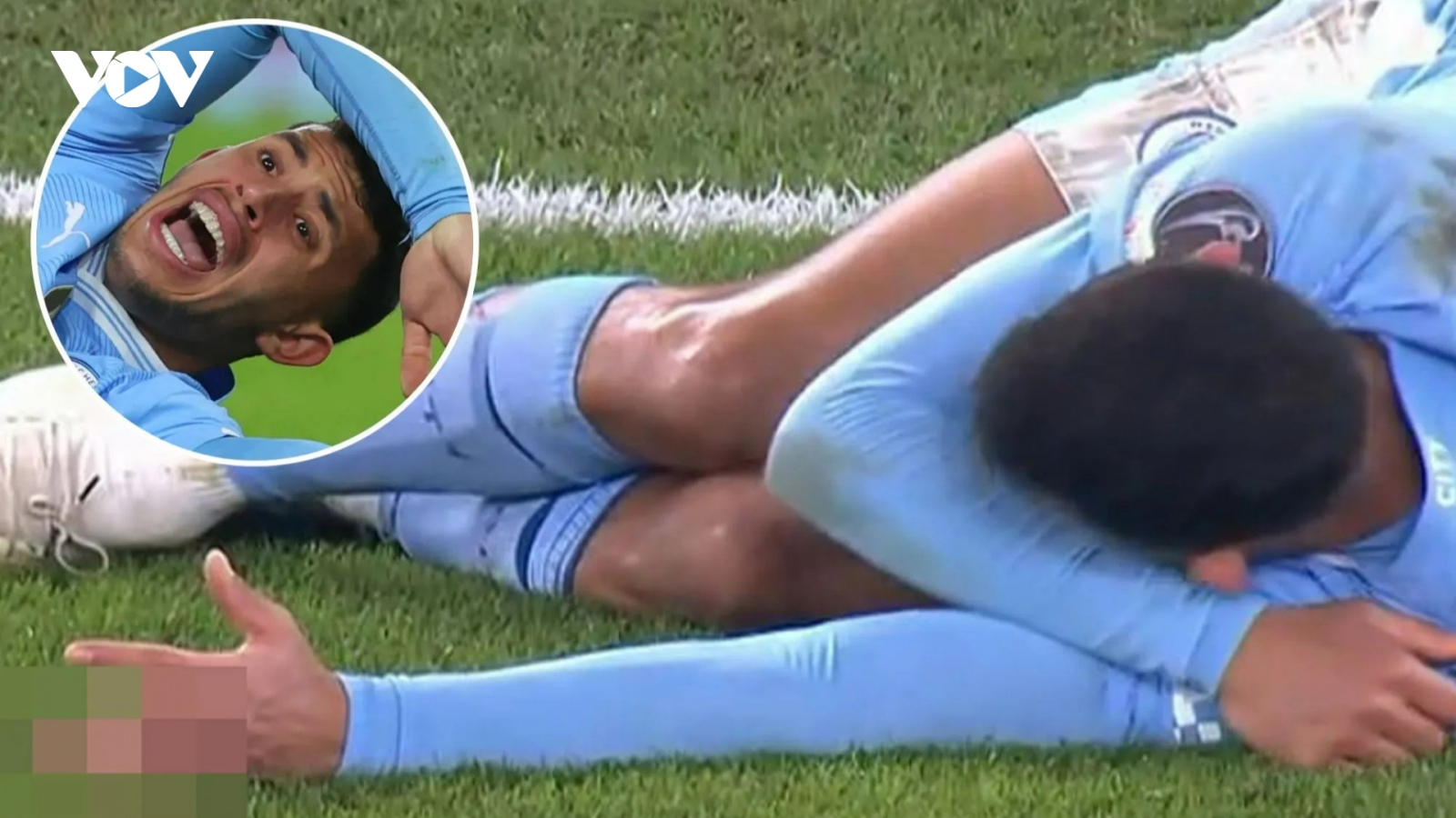 Cầu thủ Man City dính chấn thương kinh hoàng ở Cúp C1 châu Âu