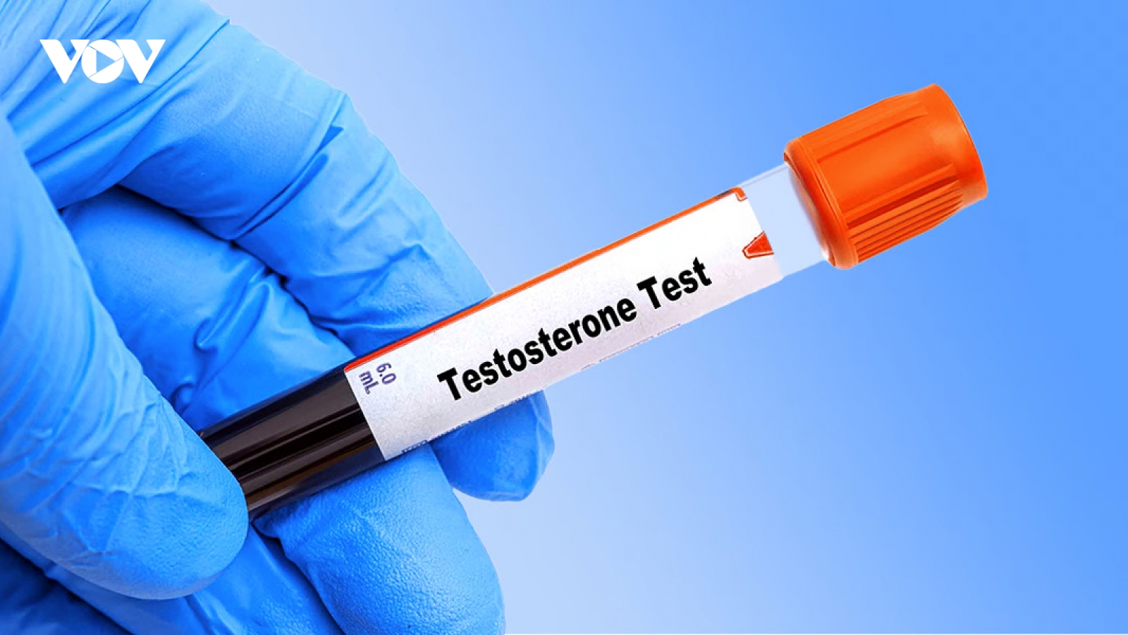 Những điều nam giới nên biết khi kiểm tra Testosterone