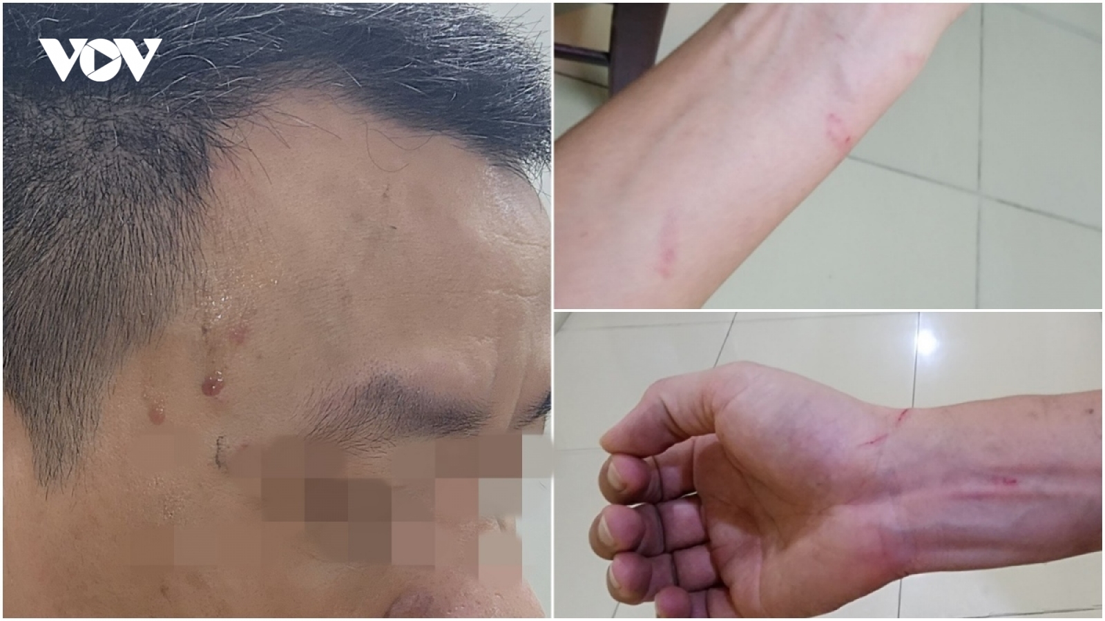 Chủ tịch Hà Nội yêu cầu khẩn trương làm rõ vụ hành hung nhà báo ở Thanh Trì