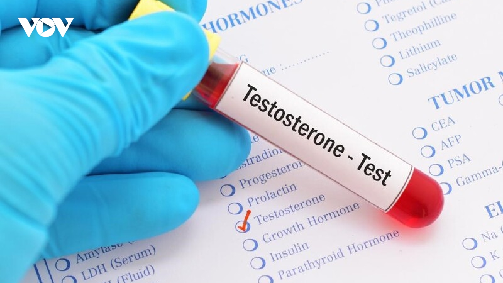 Những dấu hiệu cho thấy suy giảm hormone sinh dục