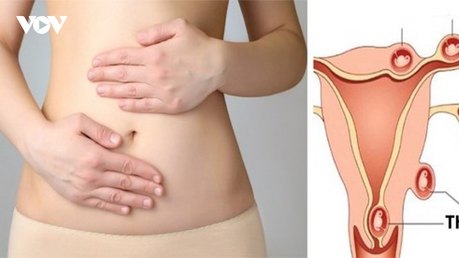 Phụ nữ có tiền sử chửa ngoài tử cung, có thể mang thai tự nhiên được không?