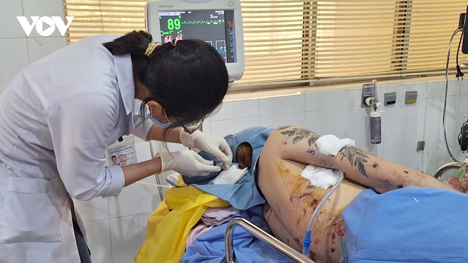 Diễn tiến mới về sức khỏe của các nạn nhân vụ nổ lò hơi ở Đồng Nai