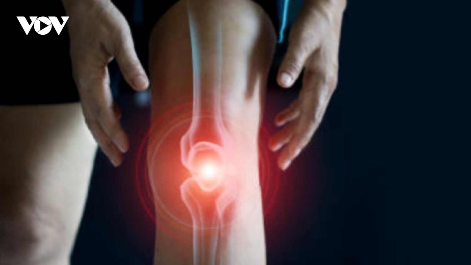10 sự thật cần biết trước khi tiến hành phẫu thuật đầu gối
