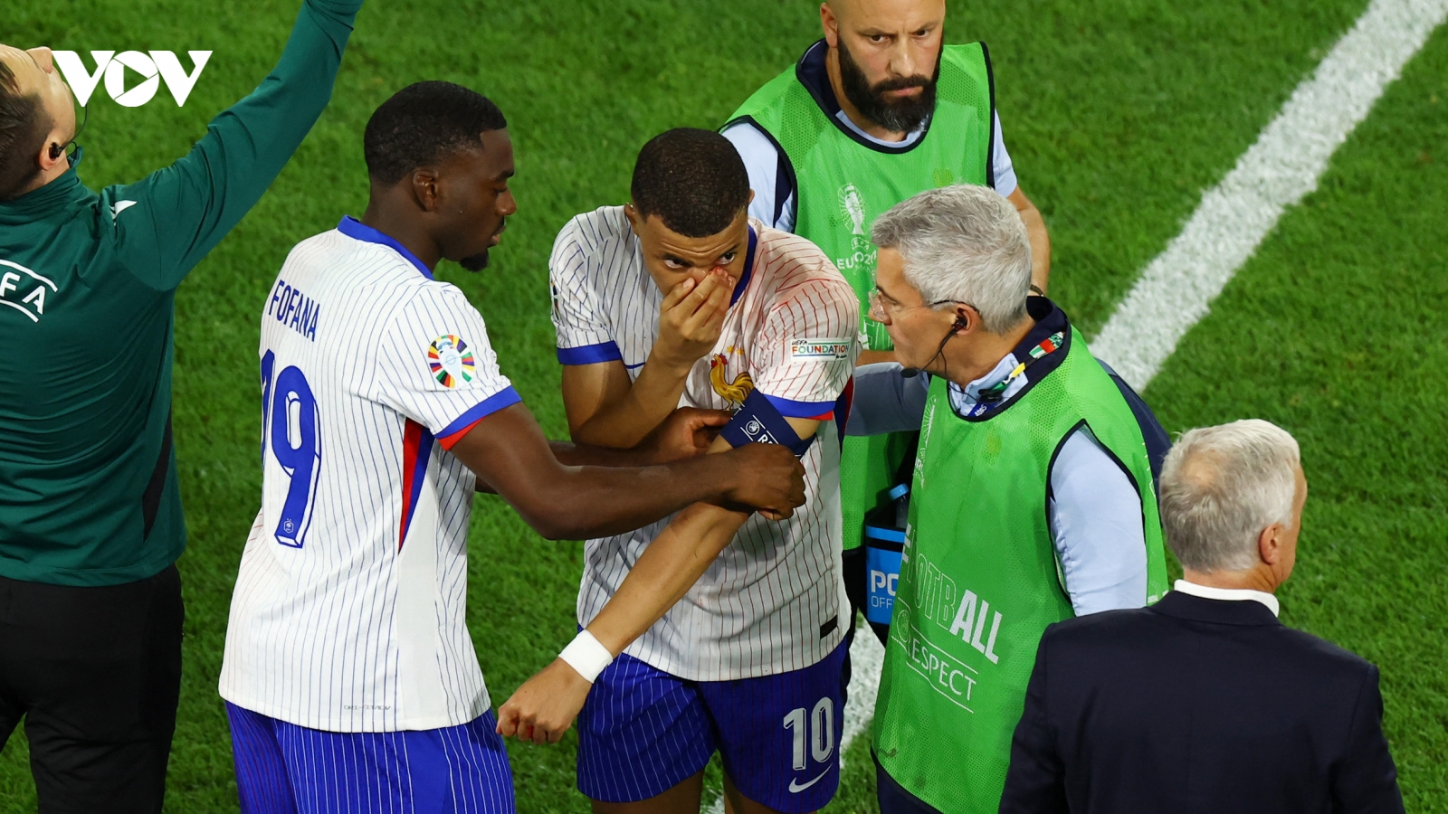 Mbappe vỡ mũi, có thể nghỉ hết vòng bảng EURO 2024