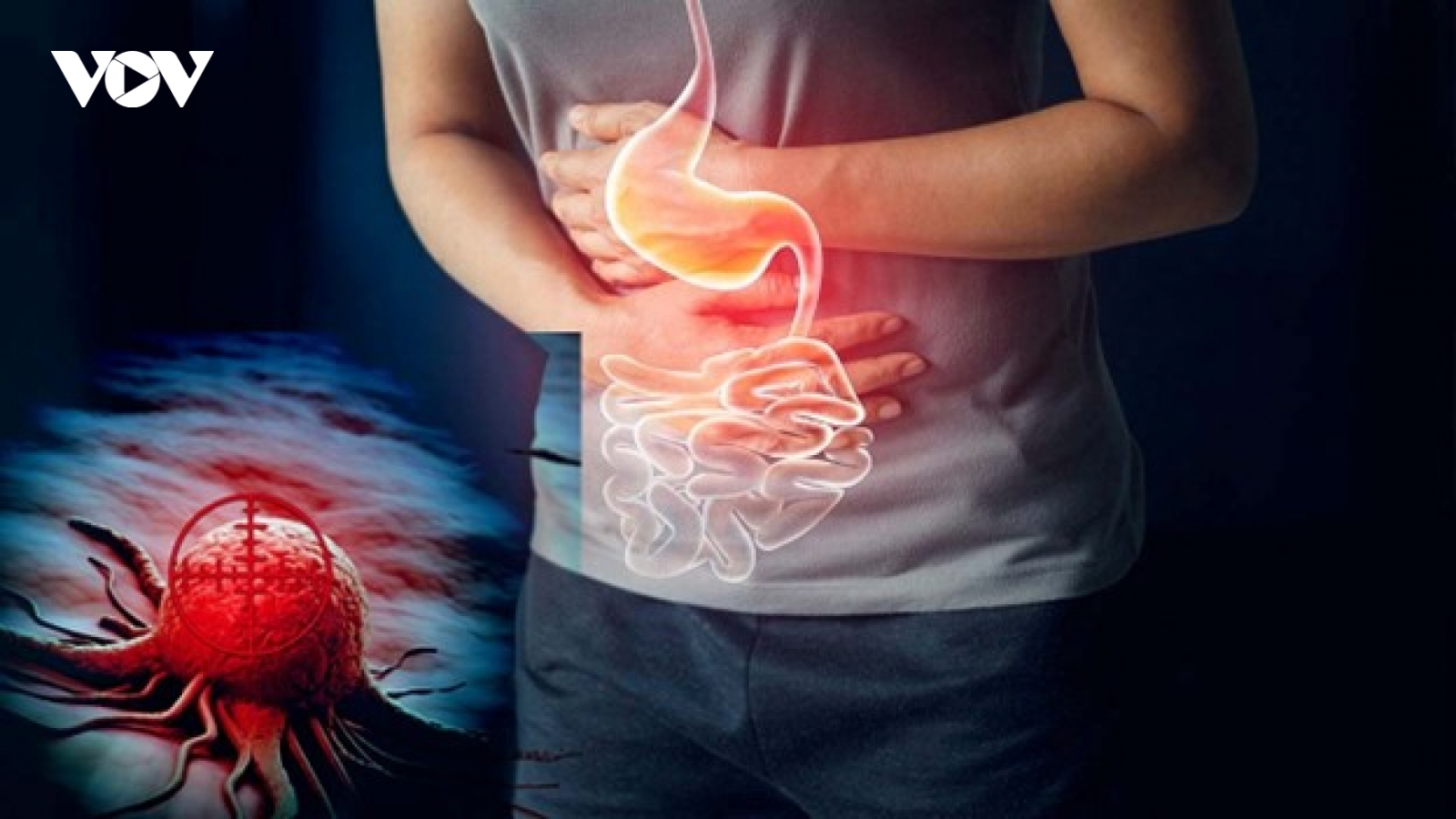 Cẩn trọng dấu hiệu cảnh báo ung thư dạ dày không phải ai cũng chú ý