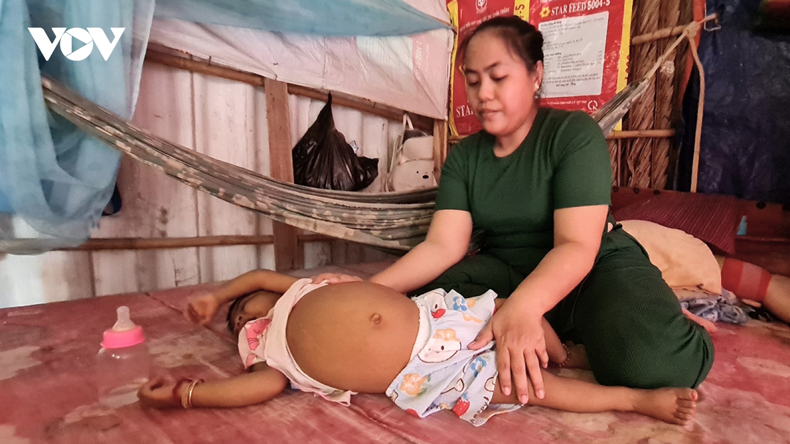 Bé Hà Nguyễn Bảo Thi cần được ghép gan để sống