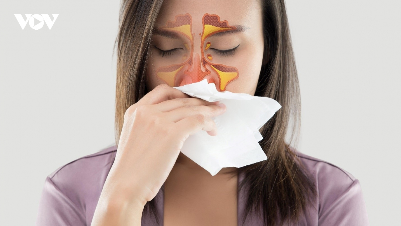 5 vị thuốc tự nhiên giúp giảm triệu chứng viêm xoang hiệu quả ít người biết