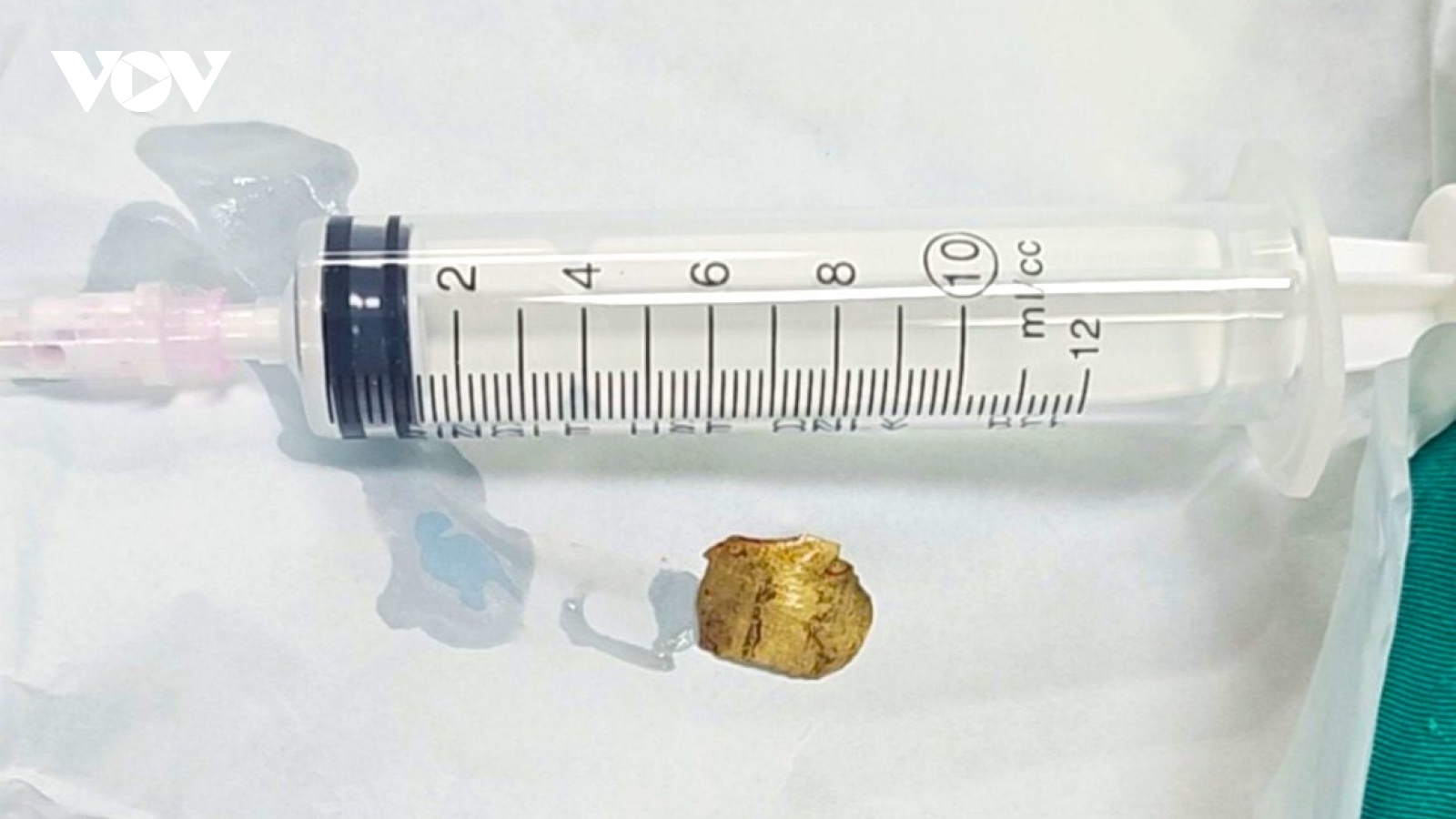 Cần Thơ: Nam thanh niên nguy kịch vì mảnh đạn văng ghim trúng cổ