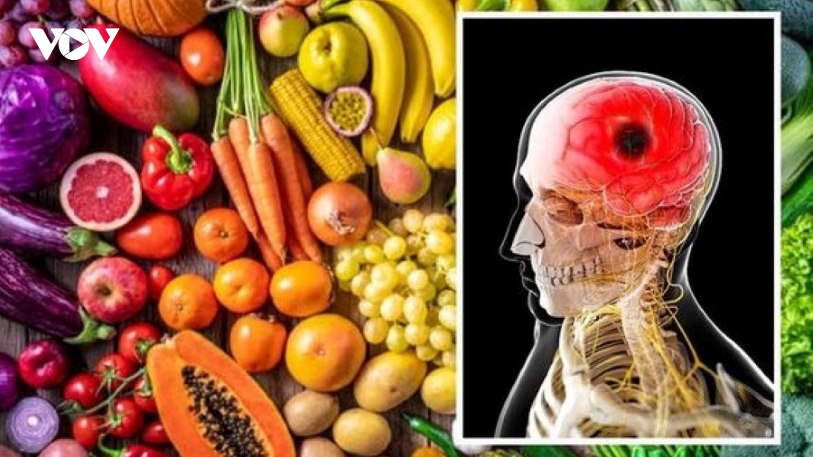 Đột quỵ không còn là nỗi lo với những thực phẩm cực sẵn ở Việt Nam này