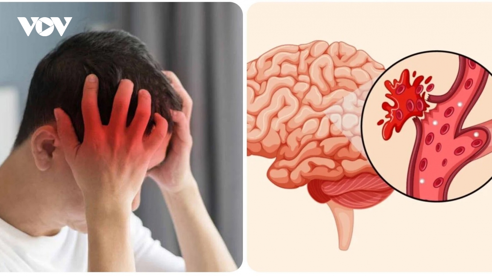 6 thói quen xấu dễ gây đột quỵ mùa hè, nhiều người không biết vẫn làm