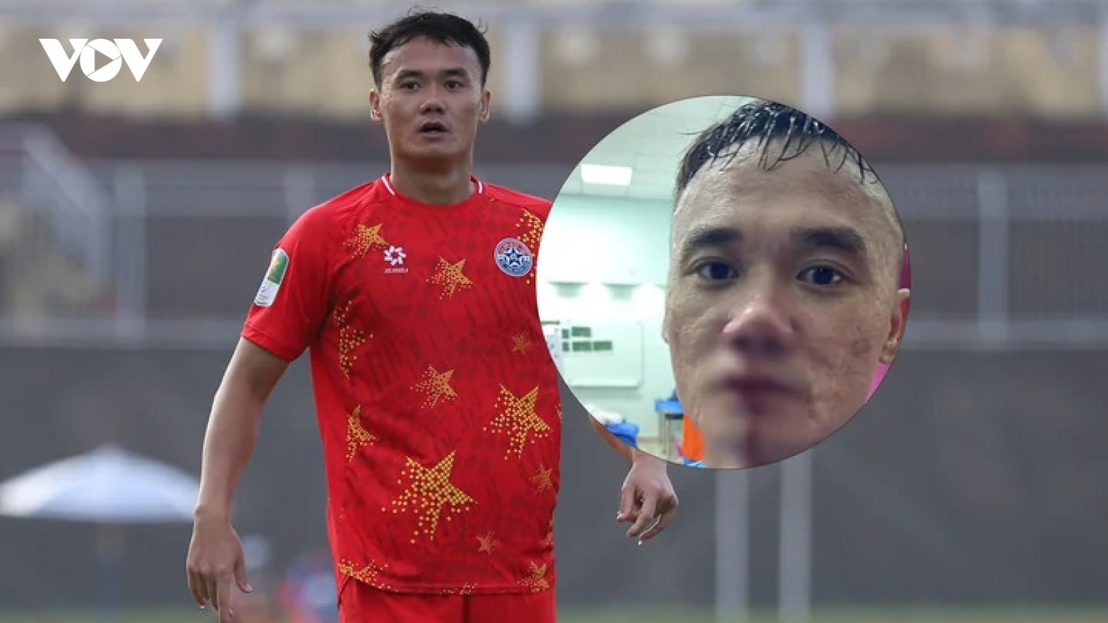 Nguyễn Xuân Nam và Vũ Văn Sơn chính thức nhận án kỷ luật nặng từ VFF vì đấm nhau