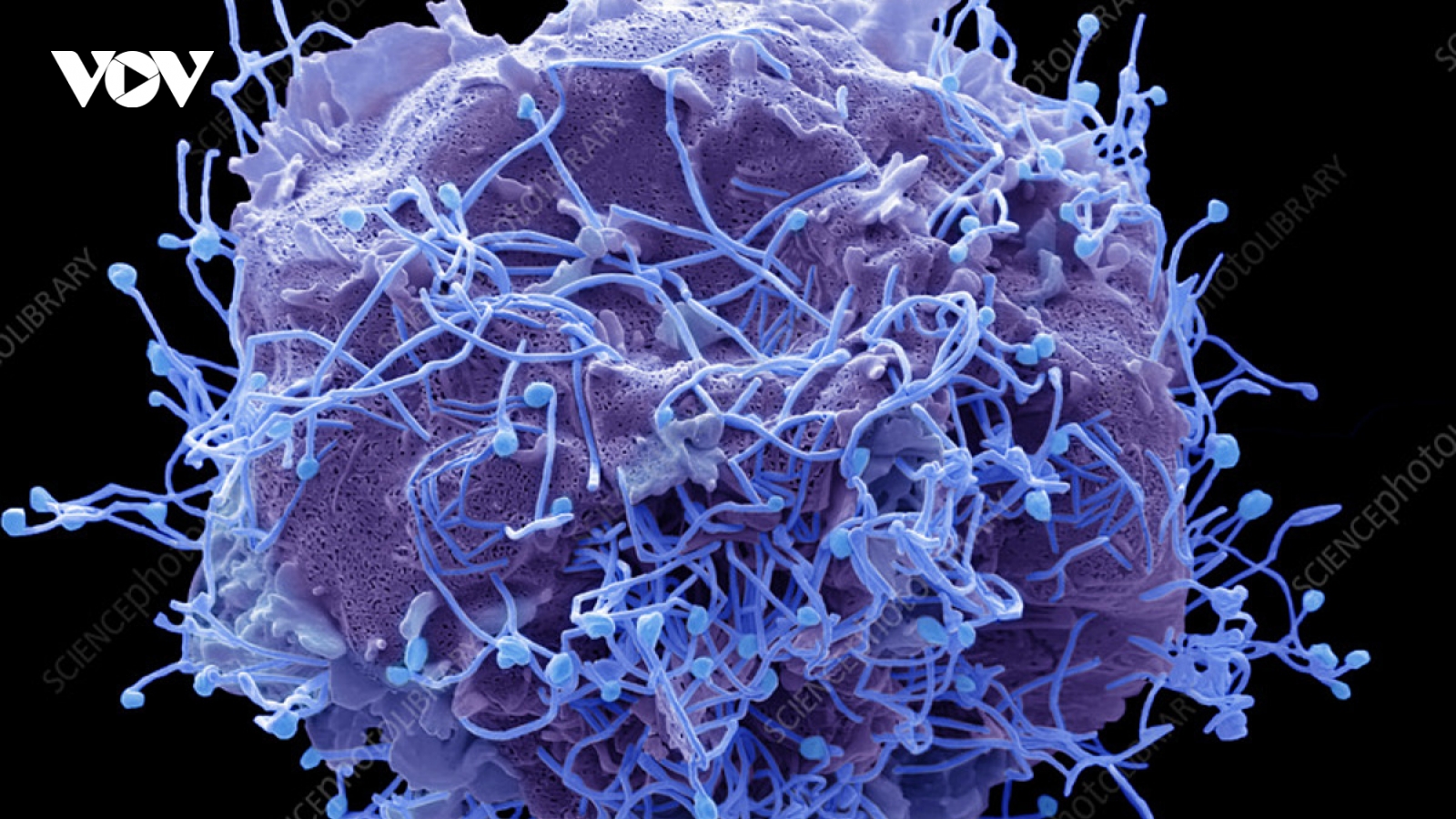 Các nước cảnh giác với virus HMPV gây bệnh đường hô hấp tại Trung Quốc