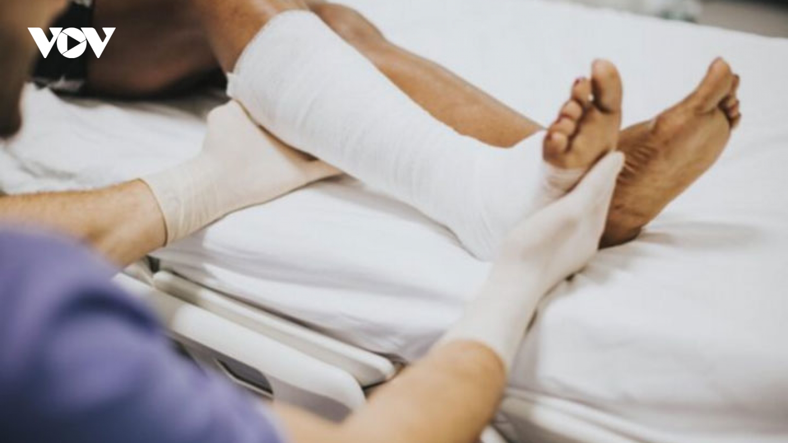 Cách sơ cứu khi bị gãy xương nhanh chóng và an toàn nhất