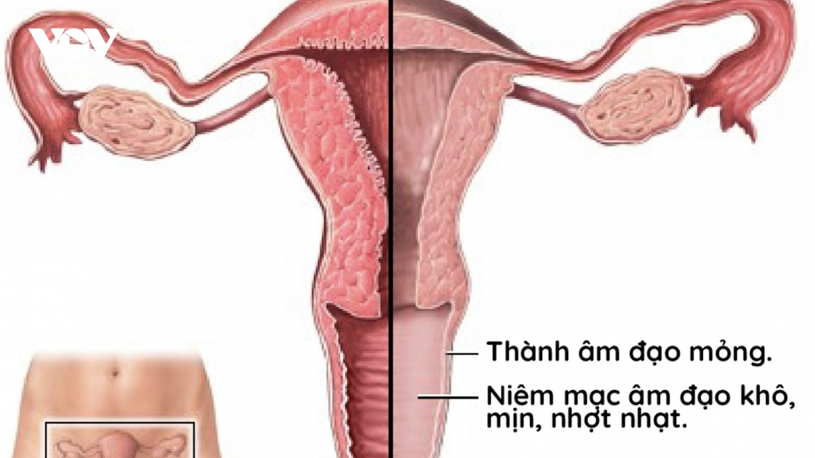 Biểu hiện khiến "cô bé" bị khô, teo, giảm ham muốn