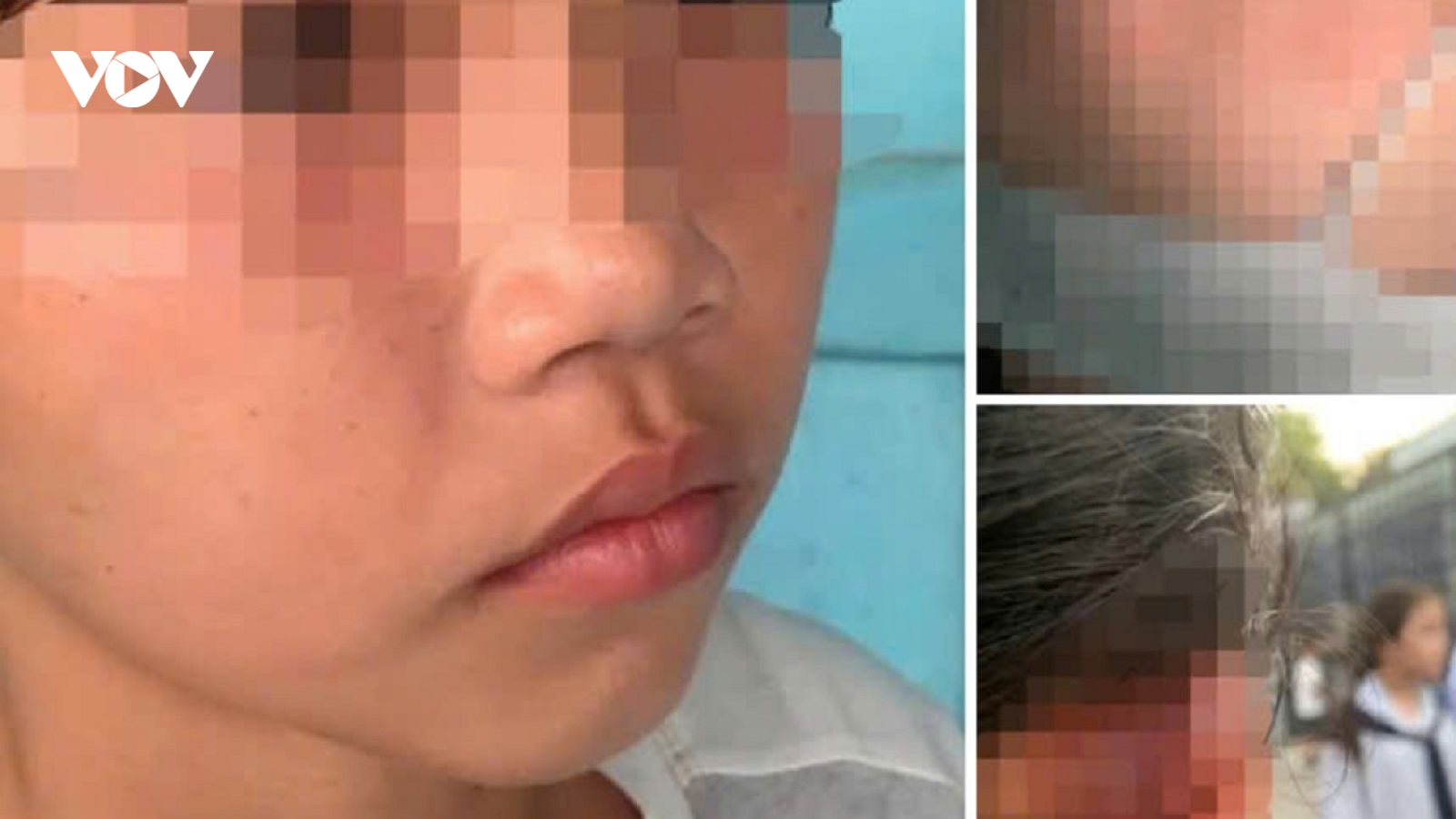 Tạm đình chỉ học trong 4 tuần đối với học sinh đánh bạn