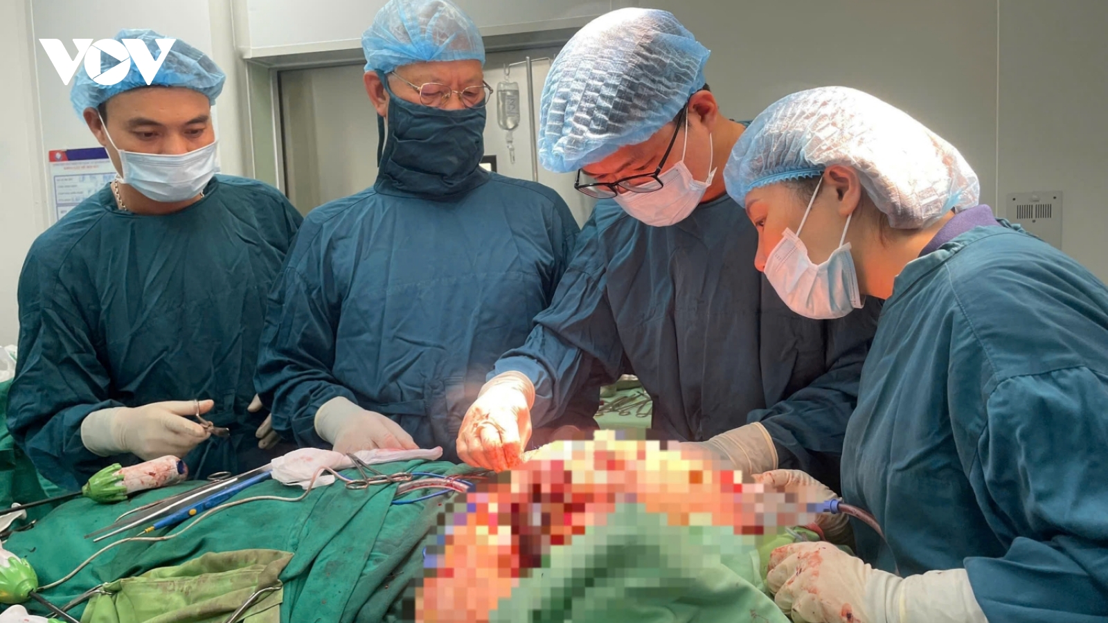 Cứu sống người phụ nữ ở Quảng Bình bị khối u khổng lồ ở vùng mặt