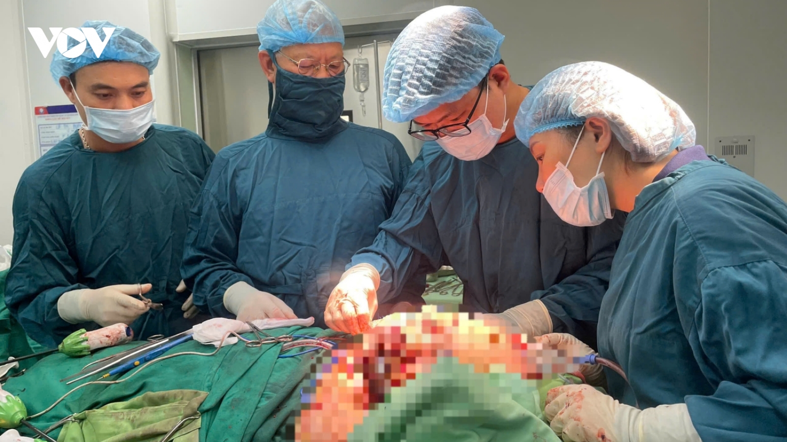 Cứu sống người phụ nữ ở Quảng Bình bị khối u khổng lồ ở vùng mặt
