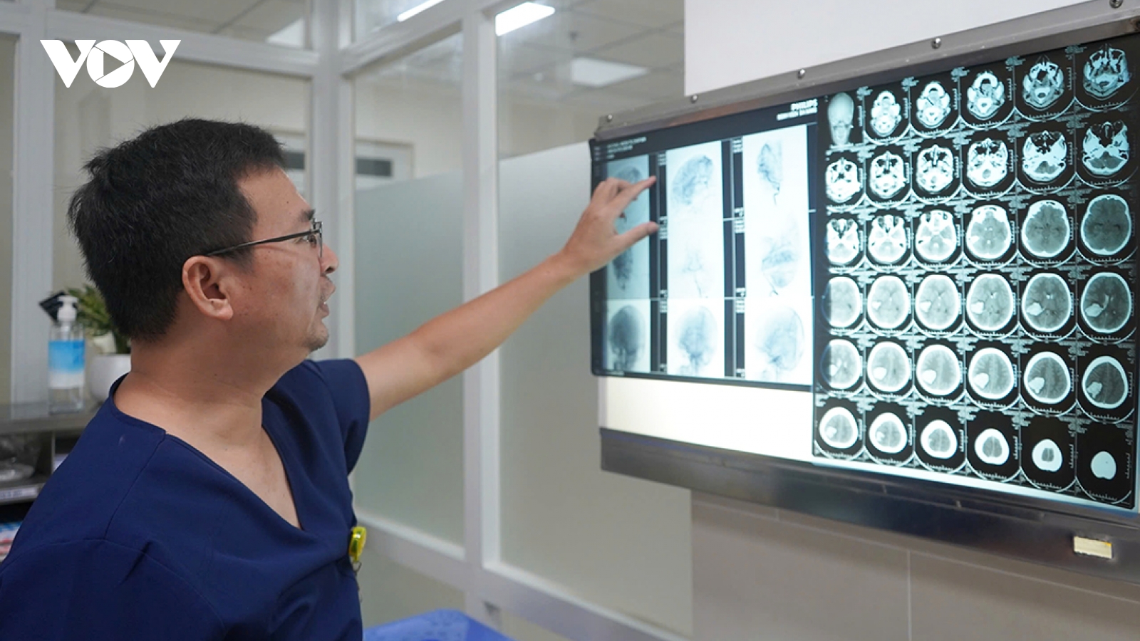 Cảnh báo đột quỵ xuất huyết não ở trẻ em
