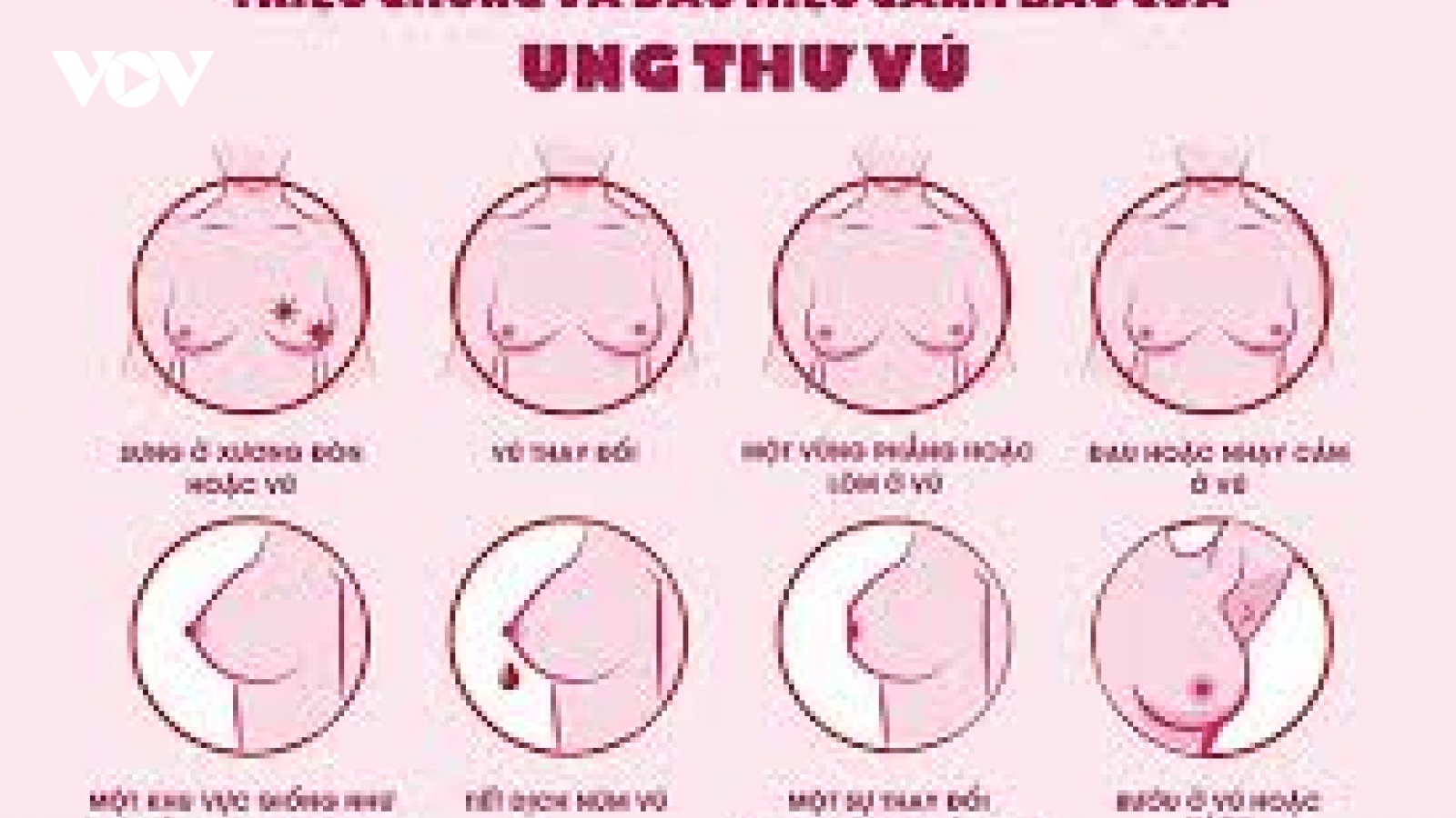 Ung thư vú không còn là “án tử” nếu được phát hiện sớm