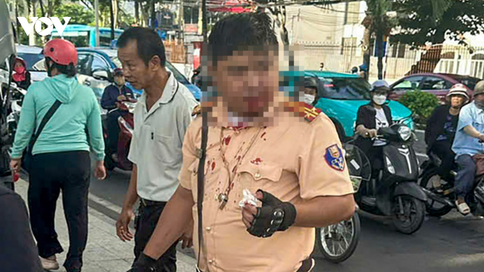 Bản tin tổng hợp: Trung tá CSGT ở Nha Trang bị người nước ngoài tấn công