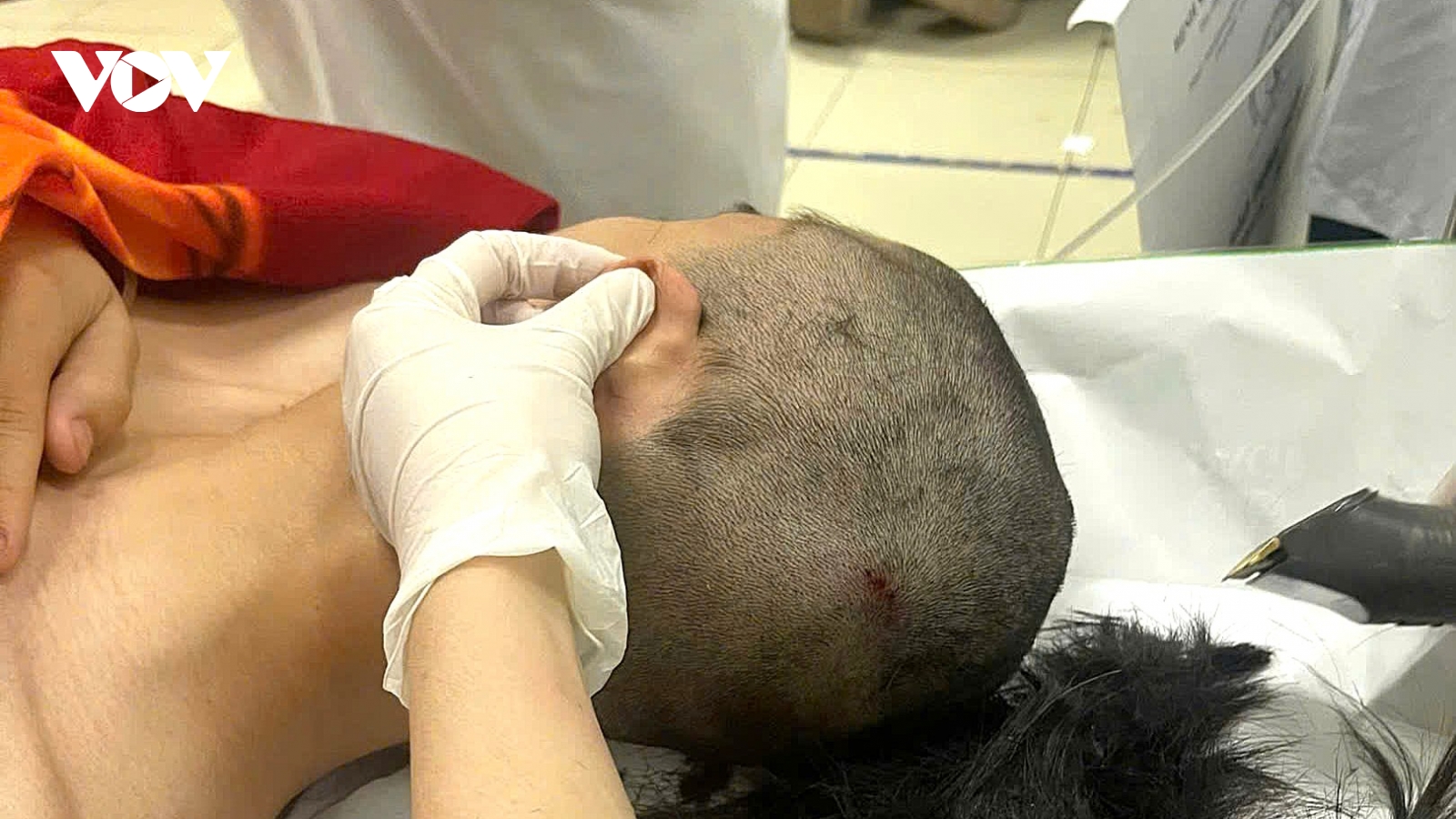 Nam sinh bị đánh tại quán bi-a phải nhập viện cấp cứu