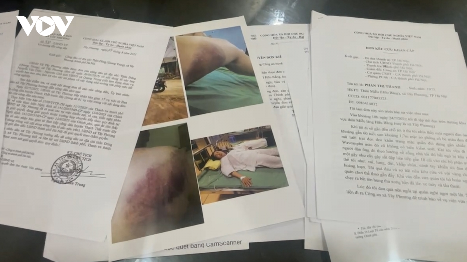 Nhiều nghi vấn về vụ người phụ nữ ở Hà Nội bị hành hung sau khi gửi đơn tố cáo