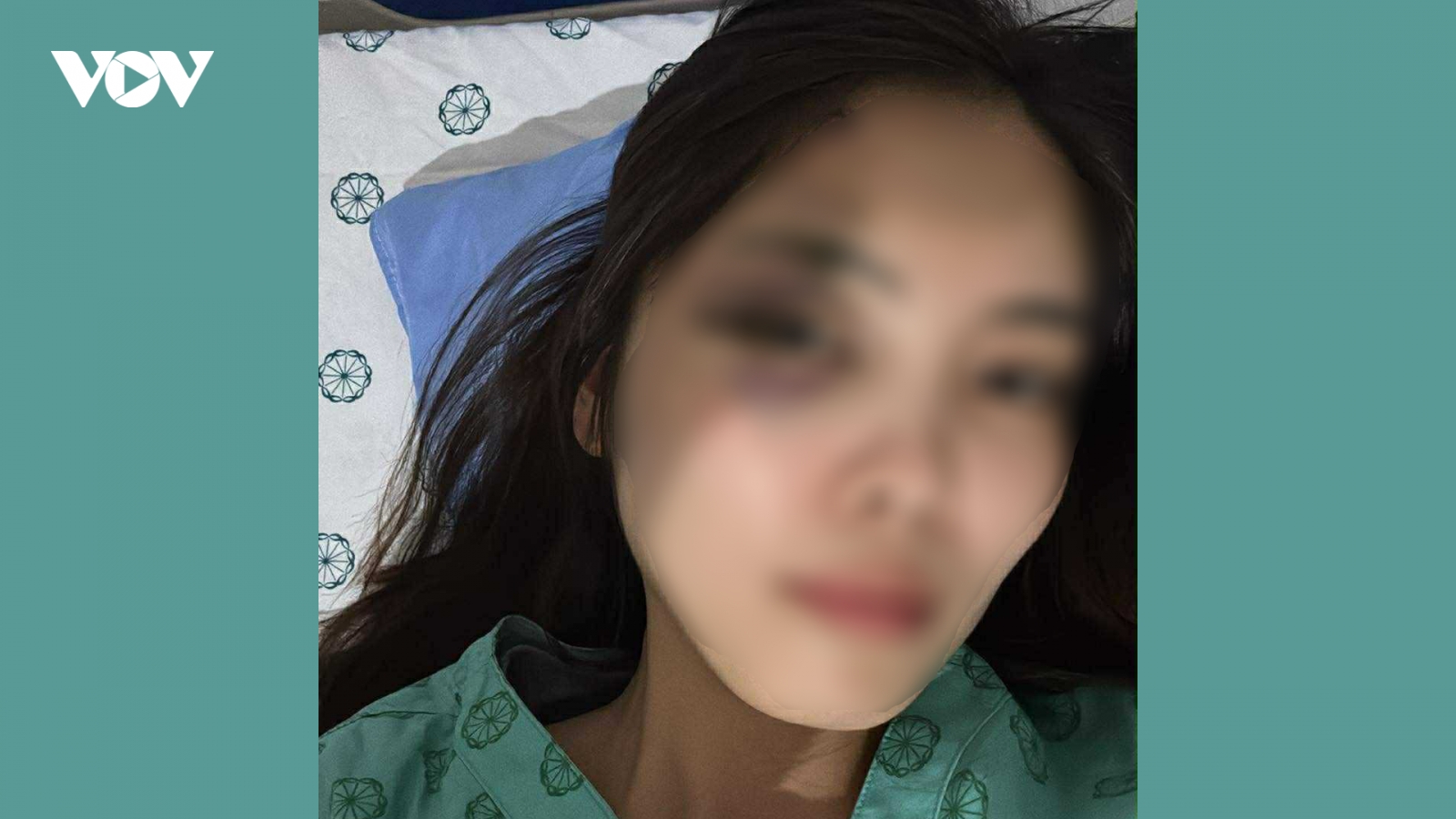 Nóng 24h: Người phụ nữ bị chồng hành hung dã man, nhập viện chấn động não