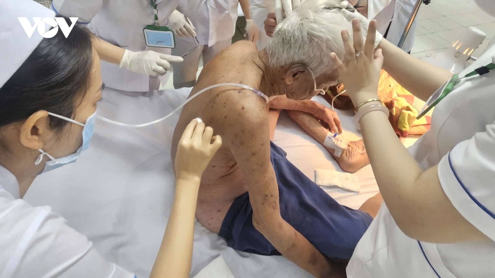 Ông lão 74 tuổi bị ong đốt hơn 100 vết tại Đồng Tháp