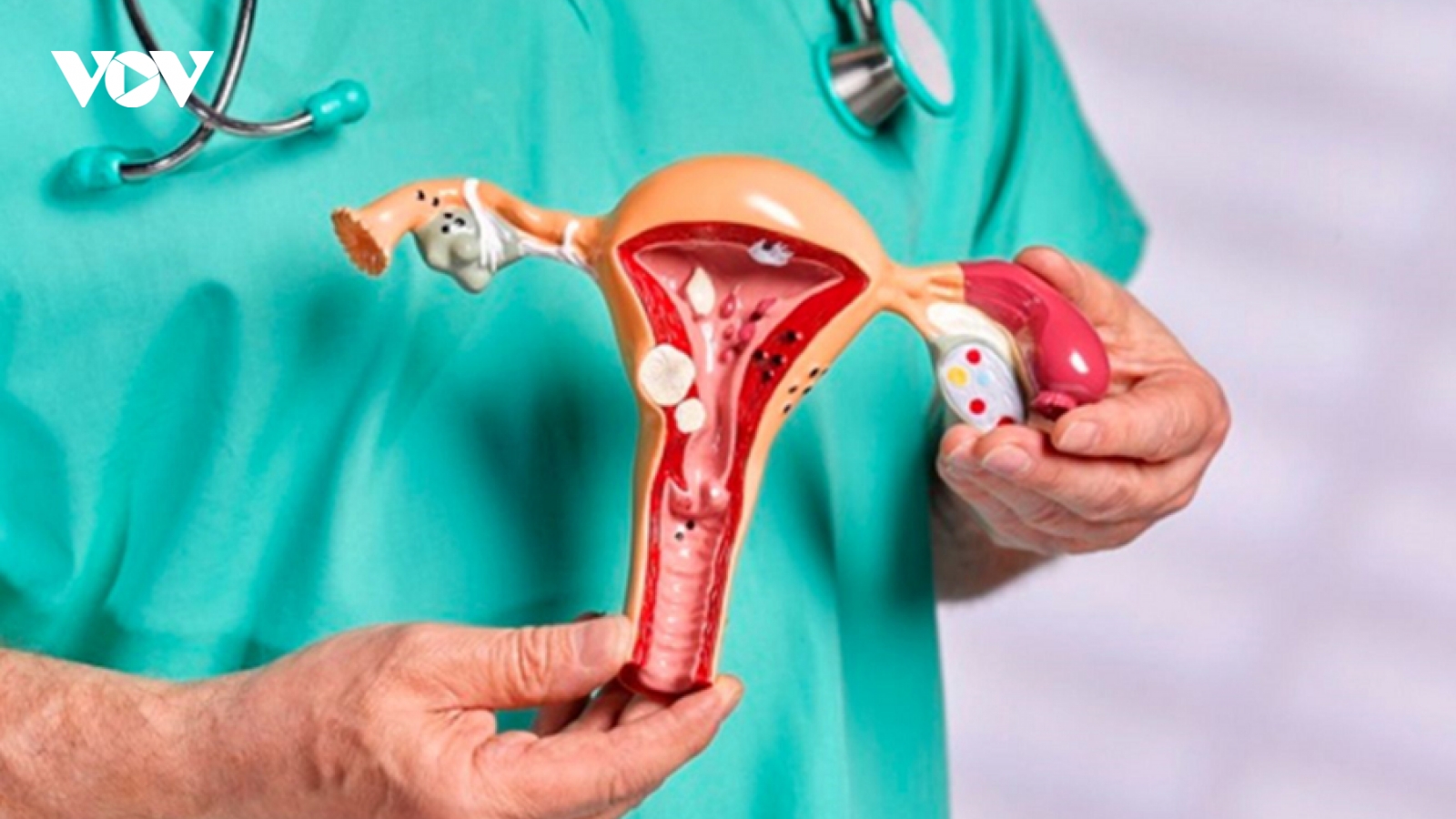 Sau phẫu thuật cắt 2 buồng trứng, việc sinh hoạt vợ chồng của tôi khá khó khăn