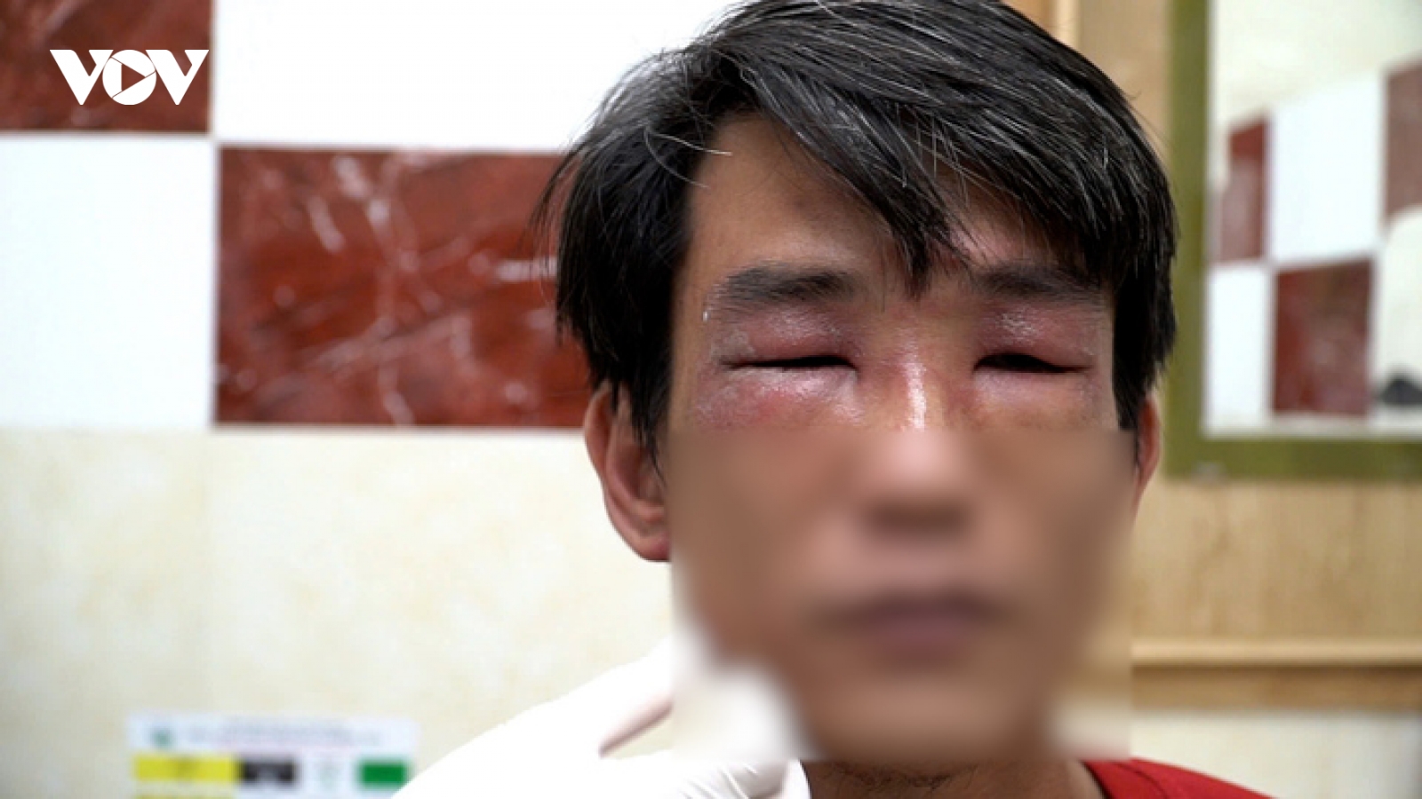 TP.HCM: Kiến ba khoang lại tấn công người, bác sĩ cảnh báo chữa trị bằng 'mẹo'