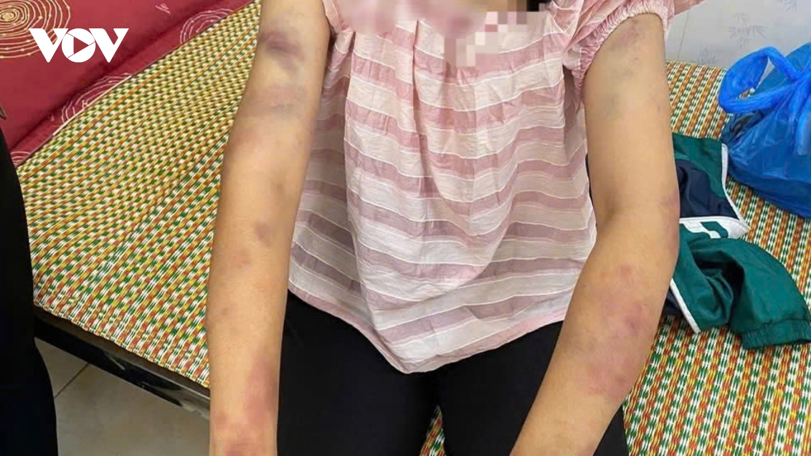 Làm rõ vụ việc bé gái nghi bị người thân bạo hành ở Thái Nguyên