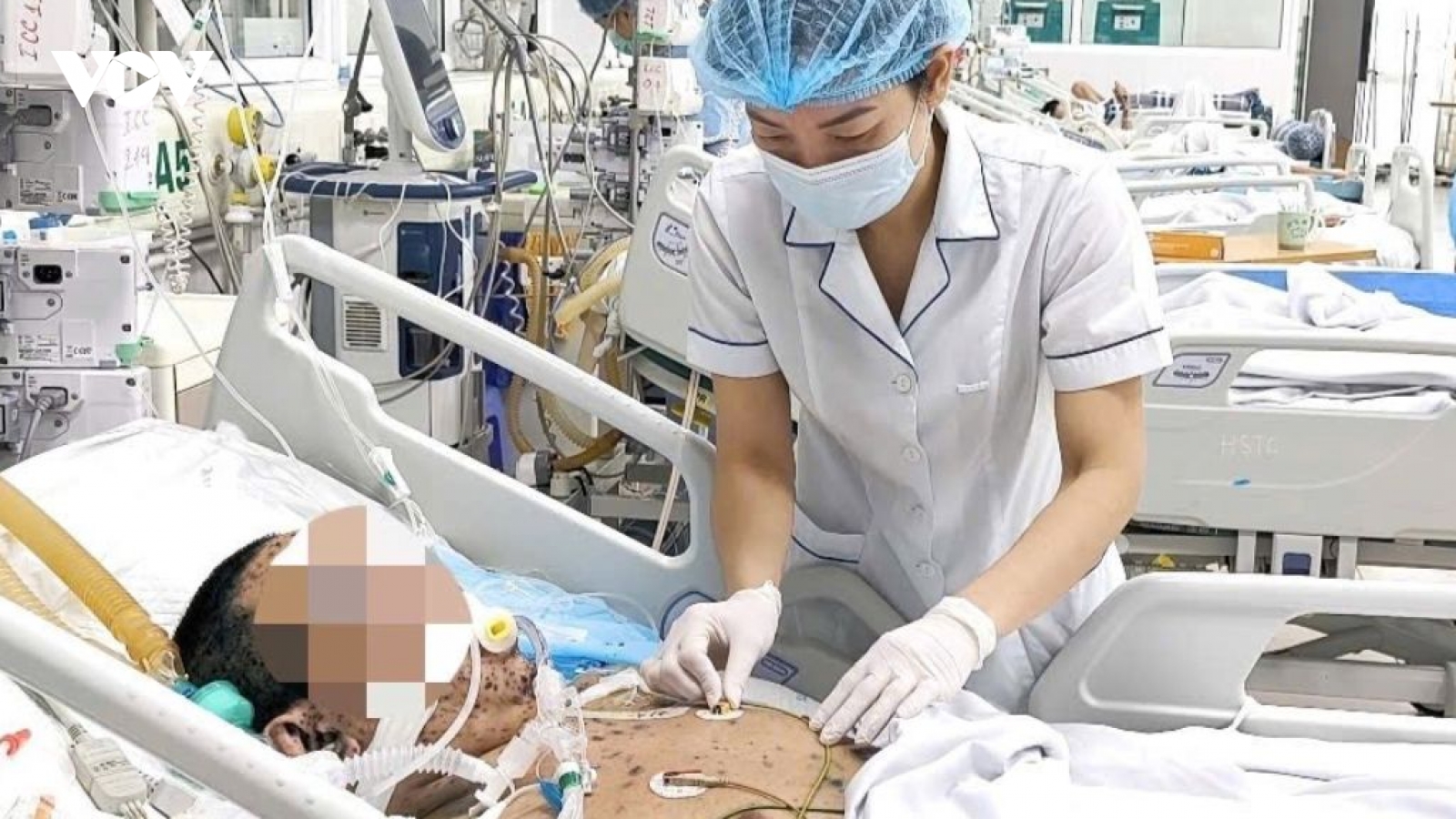 Lây thủy đậu từ con gái, ông bố trẻ nhập viện trong tình trạng nguy kịch