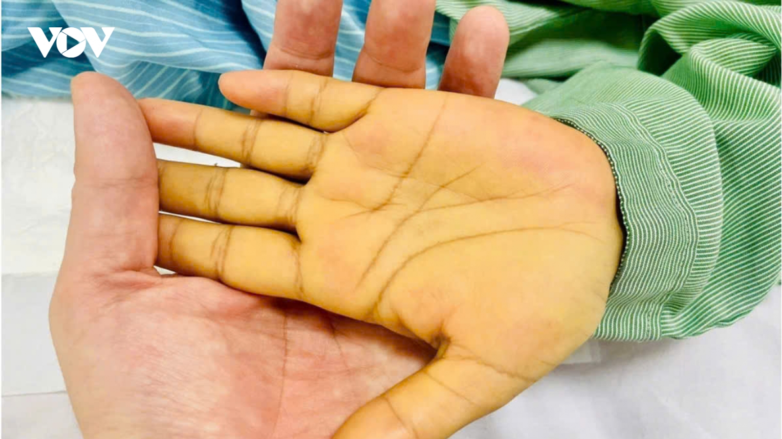 2 vị trí có màu vàng cảnh báo nguy hiểm không nên bỏ qua