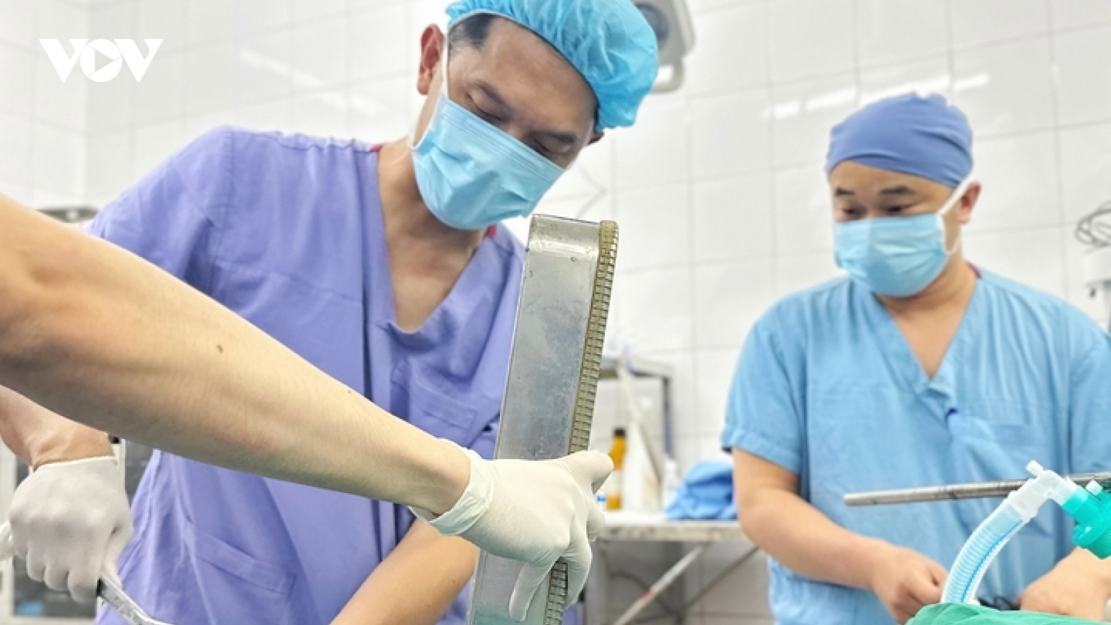 Kẹt nguyên bàn tay trong máy xay thịt, người phụ nữ 36 tuổi phải cắt cụt chi
