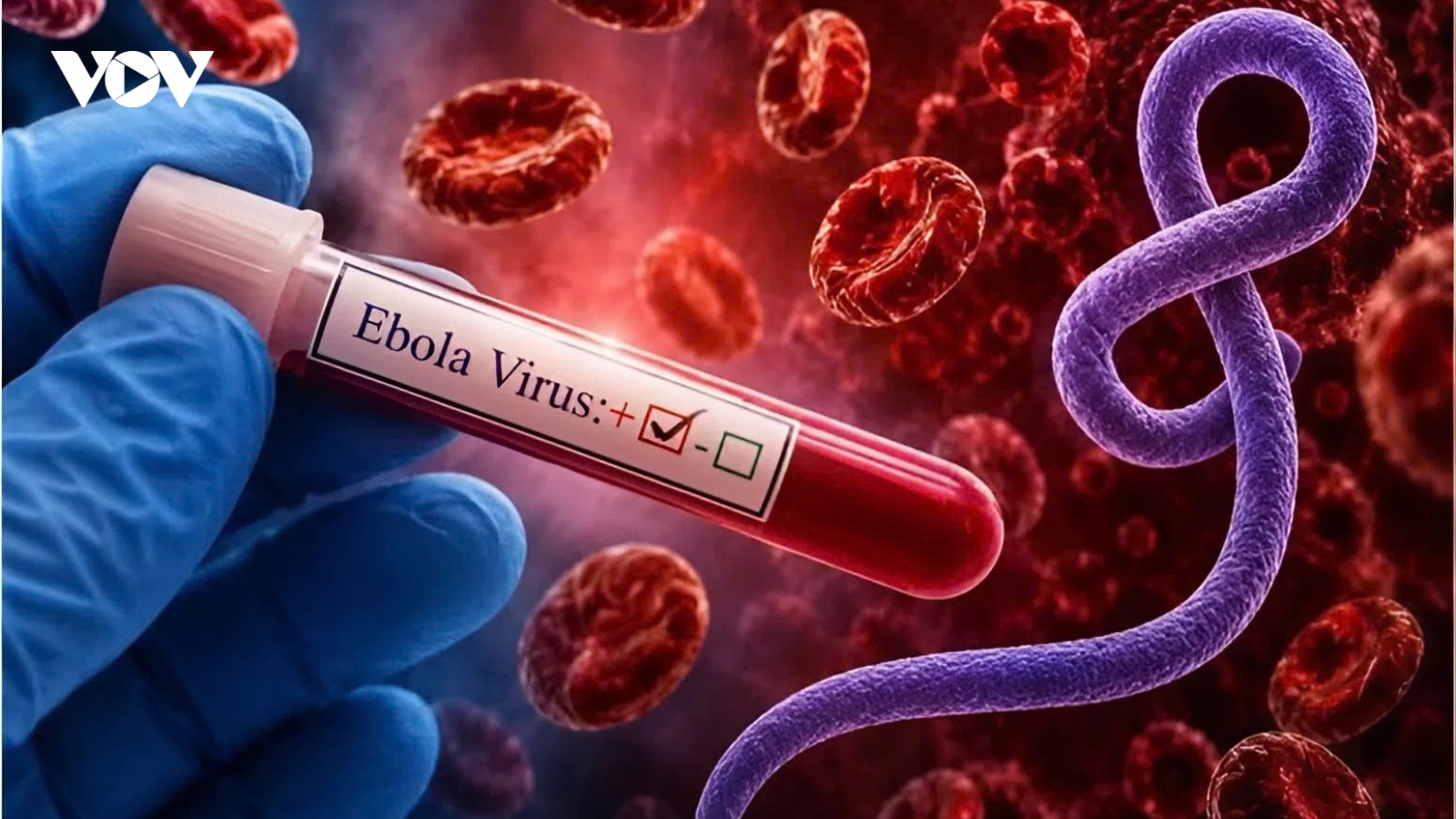 Tỷ lệ tử vong khi mắc Ebola có thể lên tới 90%