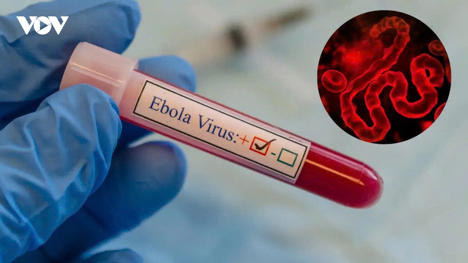 WHO nâng cảnh báo Ebola tại Congo lên mức “rất cao”