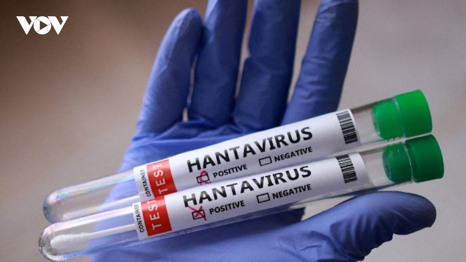 Truy vết Hantavirus: Các nhà khoa học bắt 70 con chuột ở "nơi tận cùng thế giới"
