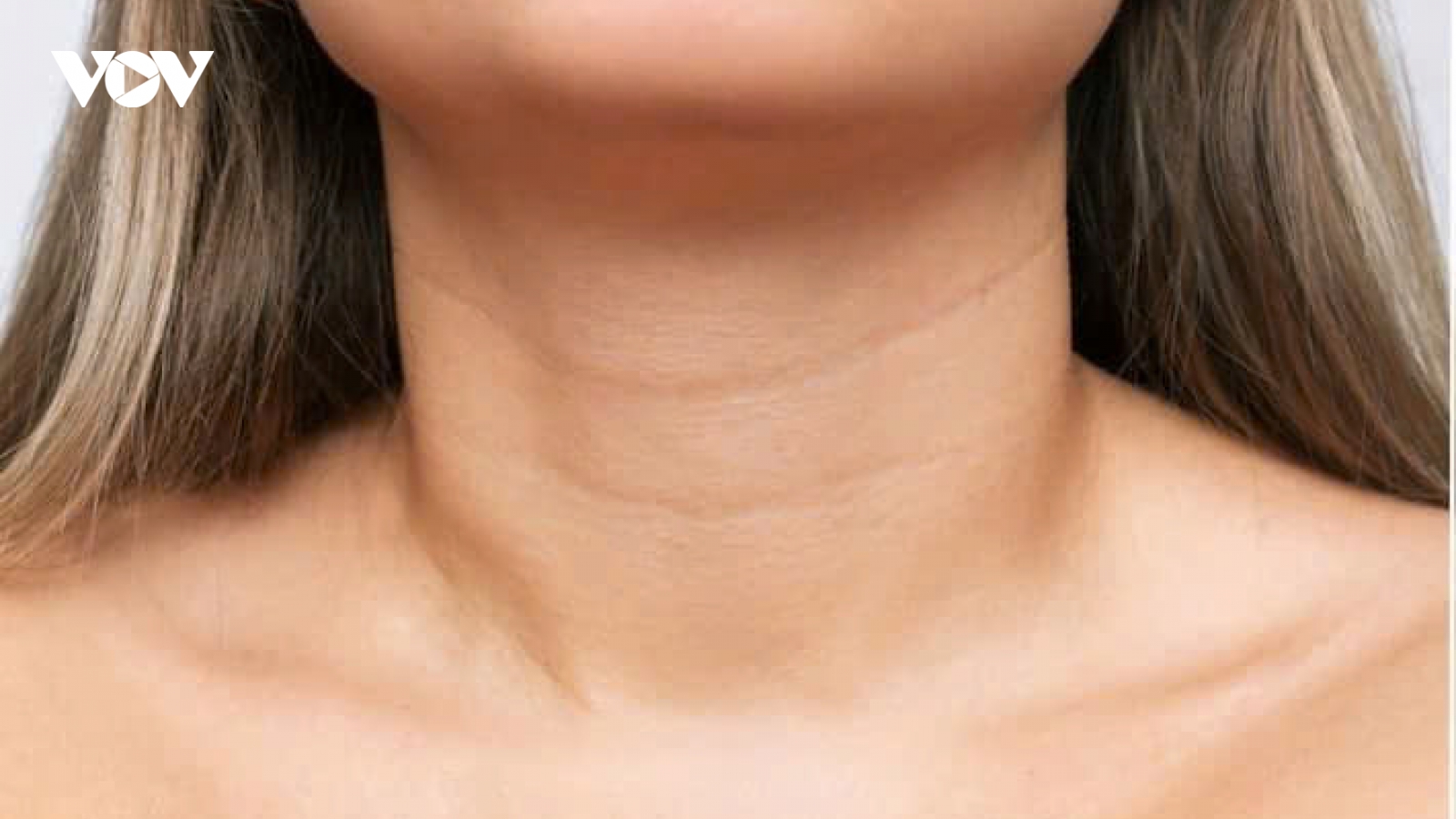 Nếp nhăn ở cổ ngày càng sâu: Làm sao cải thiện hiệu quả?
