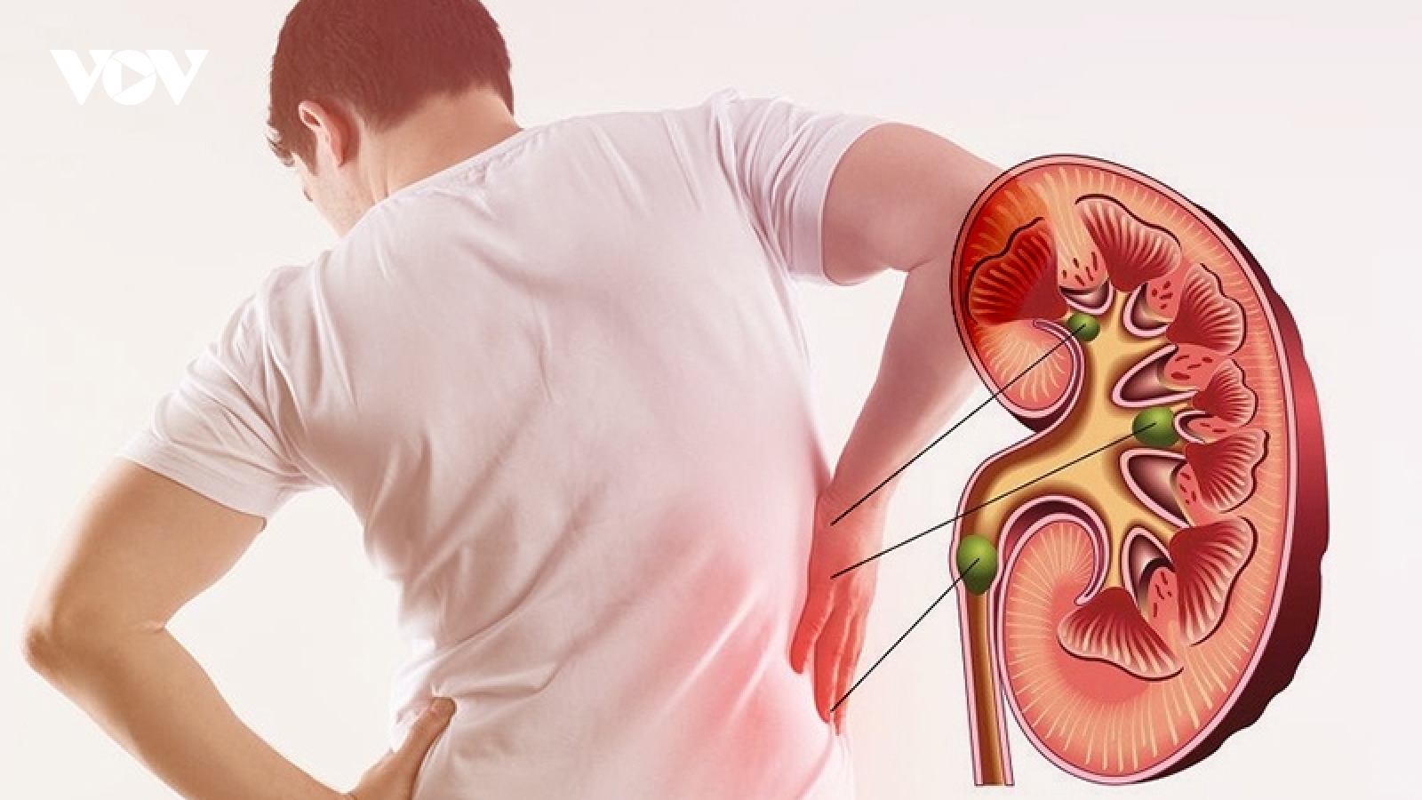 5 dấu hiệu này trong nước tiểu có thể báo hiệu tổn thương thận giai đoạn đầu