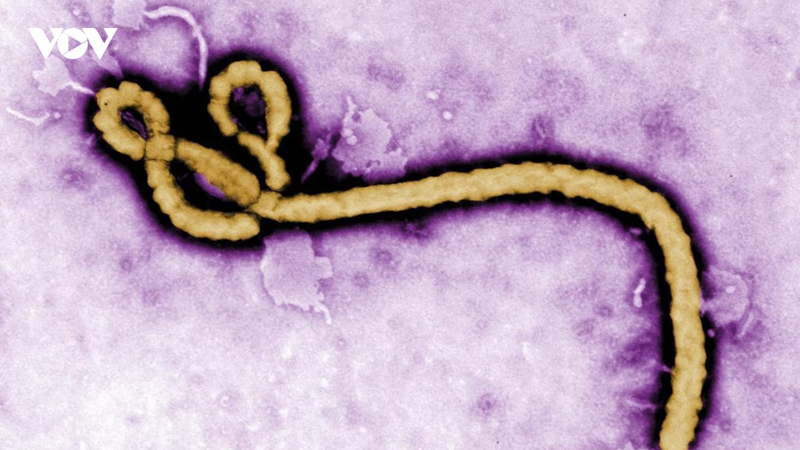Ca nhiễm Ebola đầu tiên tại Pháp chính thức khỏi bệnh và xuất viện