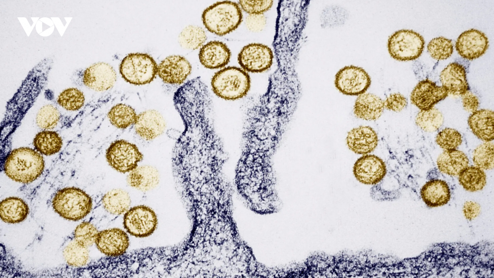 Virus Hanta bùng phát trên tàu du lịch xuyên Đại Tây Dương