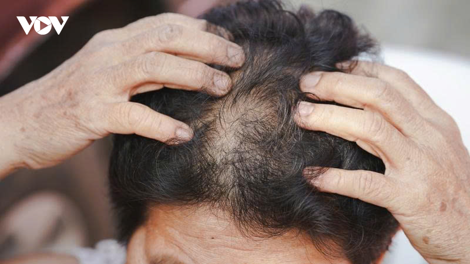 Vì sao phụ nữ trung niên dễ rụng tóc và có cách nào khắc phục?